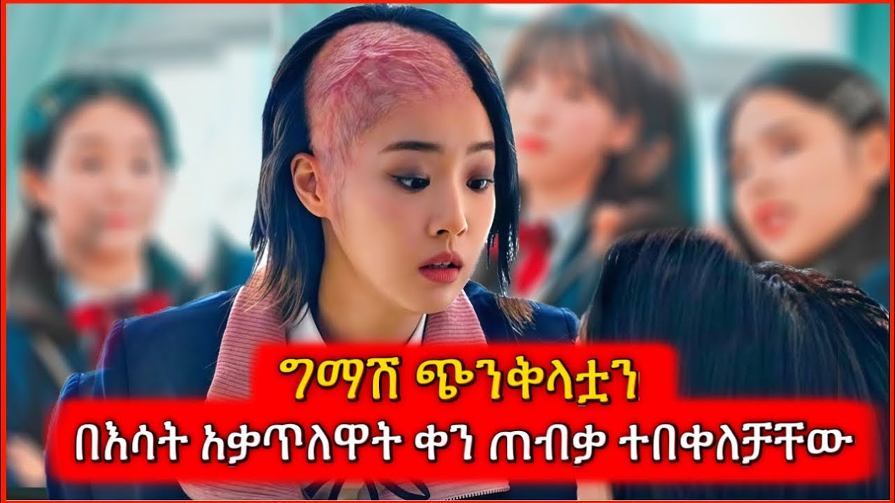 ግማሽ ጭንቅላቷን በእሳት አቃጥለዋት ቀን ጠብቃ ተበቀለቻቸው